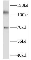 Kinesin 5C Antibody - BSA Free
