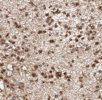 Kif3c Antibody - BSA Free