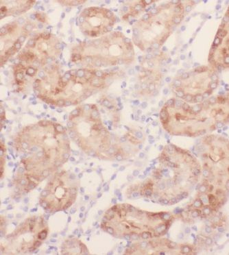 KIF26B Antibody - BSA Free