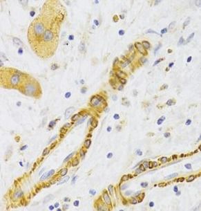 KIF1B Antibody - BSA Free