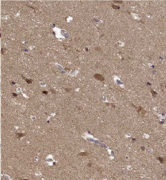 KIF19 Antibody - BSA Free