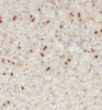 KIF18A Antibody - BSA Free