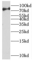 UVSSA Antibody - BSA Free