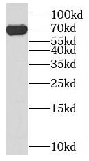 KHDC4 Antibody - BSA Free
