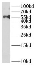 Death Ligand Signal Enhancer Antibody - BSA Free