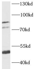 KCNN3 Antibody - BSA Free