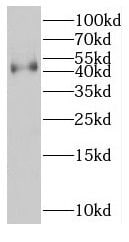 KCNK18 Antibody - BSA Free