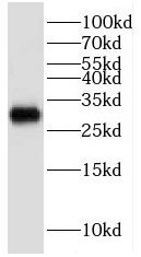 KCNIP4 Antibody - BSA Free