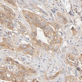 VABP Antibody - BSA Free