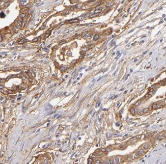Kv5.1 Antibody - BSA Free