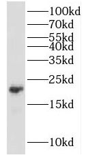 KCNE1 Antibody - BSA Free