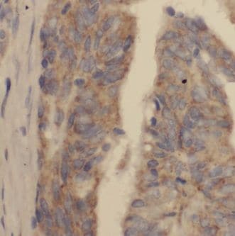 KBTBD2 Antibody - BSA Free