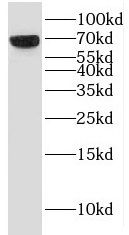 KBTBD10 Antibody - BSA Free
