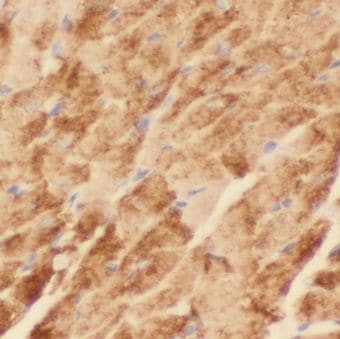 KBTBD10 Antibody - BSA Free