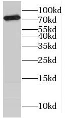 katanin-p80 Antibody - BSA Free