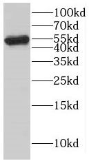 KATNAL1 Antibody - BSA Free