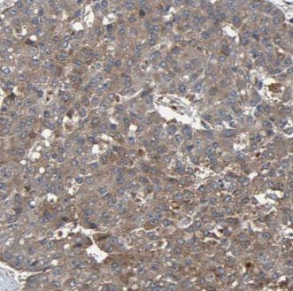 JPH2 Antibody - BSA Free
