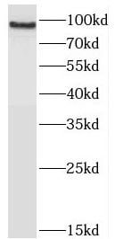 JAKMIP2 Antibody - BSA Free