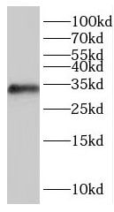 IYD Antibody - BSA Free