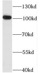 IP3KC Antibody - BSA Free