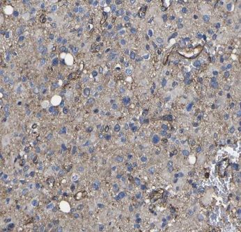 ITPKA Antibody - BSA Free