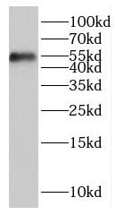 ITPKA Antibody - BSA Free