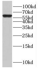 ISYNA1 Antibody - BSA Free
