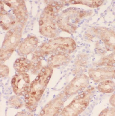 IQSEC2 Antibody - BSA Free