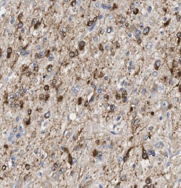 IPPK Antibody - BSA Free