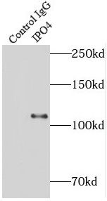 Importin4 Antibody - BSA Free