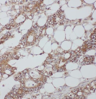 Importin4 Antibody - BSA Free