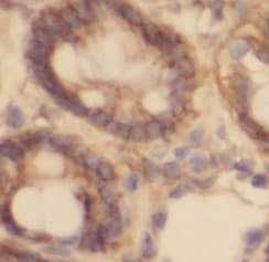 PLA2G6 Antibody - BSA Free