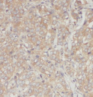 Inversin Antibody - BSA Free