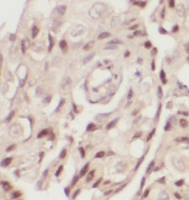 INTS8 Antibody - BSA Free