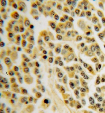 INPP5B Antibody - BSA Free