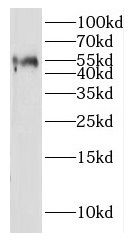 IGSF21 Antibody - BSA Free