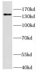 IFT140 Antibody - BSA Free