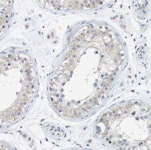 IFT122 Antibody - BSA Free
