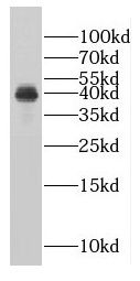 FAM84B Antibody - BSA Free