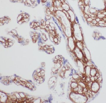 FAM76A Antibody - BSA Free
