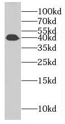 FAM71F2 Antibody - BSA Free