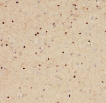 FAM71E2 Antibody - BSA Free