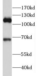 FAM65B Antibody - BSA Free