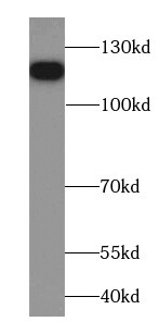 FAM186B Antibody - BSA Free
