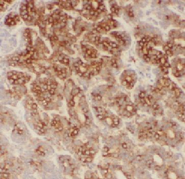FAM185A Antibody - BSA Free