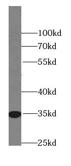 FAM164C Antibody - BSA Free