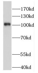 FAM160B1 Antibody - BSA Free