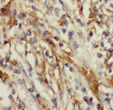 FAM156A Antibody - BSA Free