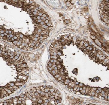 FAM133A Antibody - BSA Free