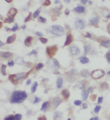 FAM124B Antibody - BSA Free